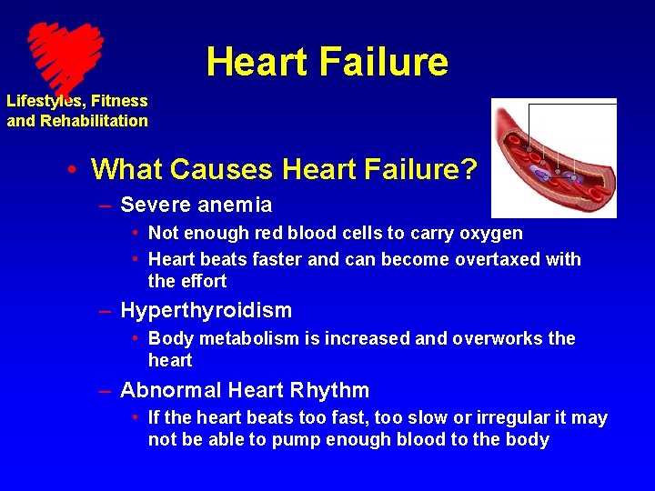 Heart Failure Lifestyles, Fitness and Rehabilitation • What Causes Heart Failure? – Severe anemia