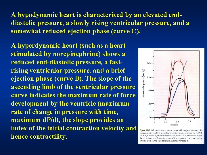 A hypodynamic heart is characterized by an elevated enddiastolic pressure, a slowly rising ventricular A hypodynamic heart is characterized by an elevated enddiastolic pressure, a slowly rising ventricular