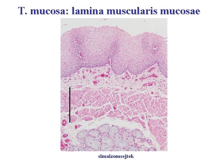 T. mucosa: lamina muscularis mucosae simaizomsejtek 