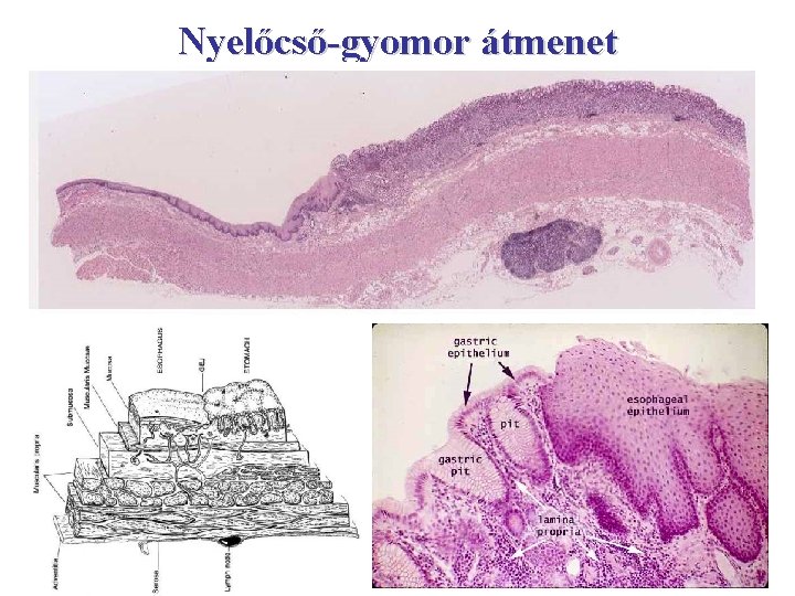 Nyelőcső-gyomor átmenet 