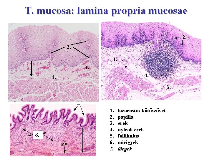 T. mucosa: lamina propria mucosae 2. 2. 1. 5. 3. 4. 1. 3. 6.