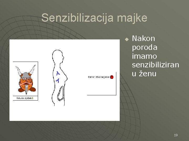 Senzibilizacija majke u Nakon poroda imamo senzibiliziran u ženu 19 