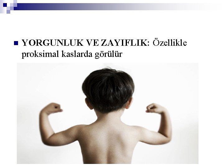 n YORGUNLUK VE ZAYIFLIK: Özellikle proksimal kaslarda görülür 