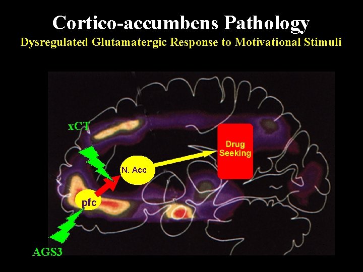 Cortico-accumbens Pathology Dysregulated Glutamatergic Response to Motivational Stimuli x. CT N. Acc pfc AGS