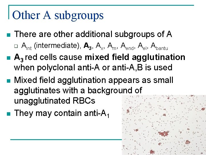 Other A subgroups n There are other additional subgroups of A q n n