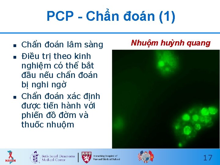 PCP - Chẩn đoán (1) n n n Chẩn đoán lâm sàng Điều trị