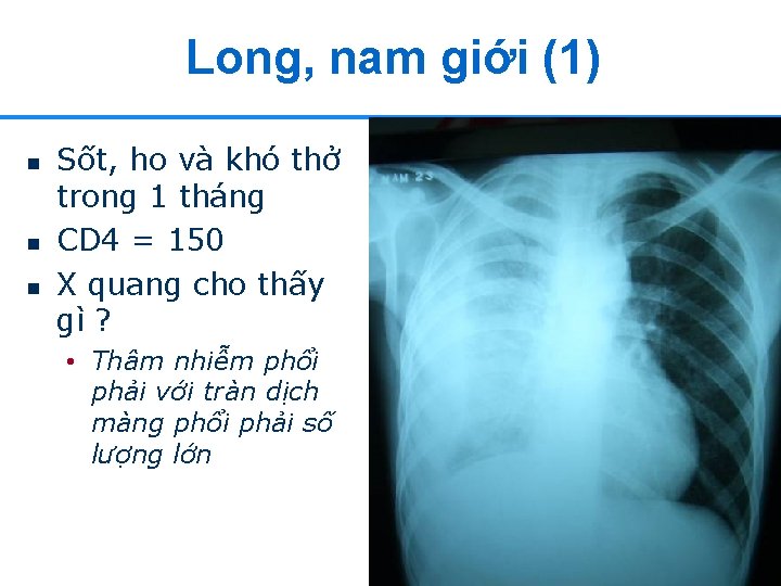 Long, nam giới (1) n n n Sốt, ho và khó thở trong 1