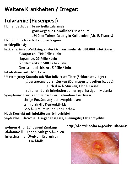 Weitere Krankheiten / Erreger: Tularämie (Hasenpest) Humanpathogen: Francisella tularensis gramnegatives, rundliches Bakterium 1912 im