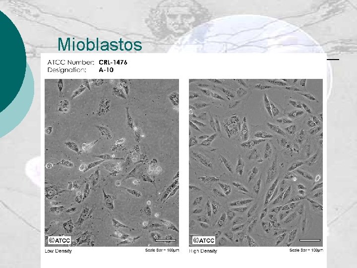 Mioblastos 