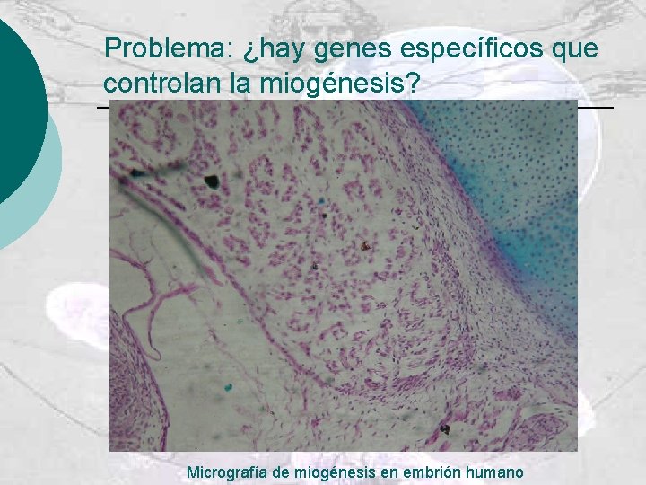 Problema: ¿hay genes específicos que controlan la miogénesis? Micrografía de miogénesis en embrión humano