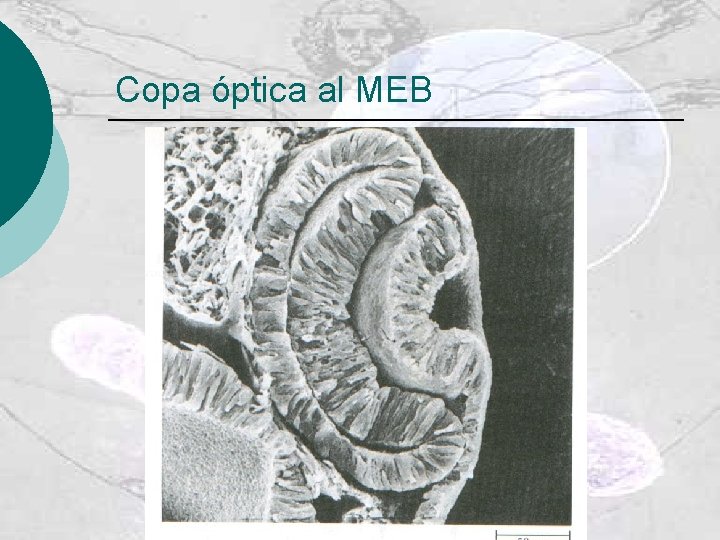 Copa óptica al MEB 