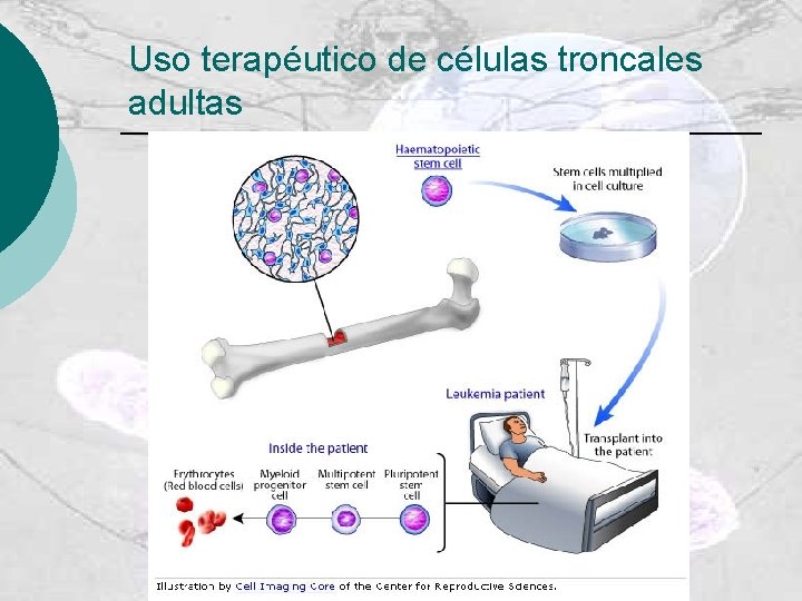 Uso terapéutico de células troncales adultas 