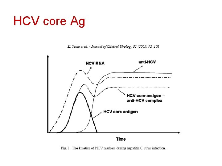 HCV core Ag 