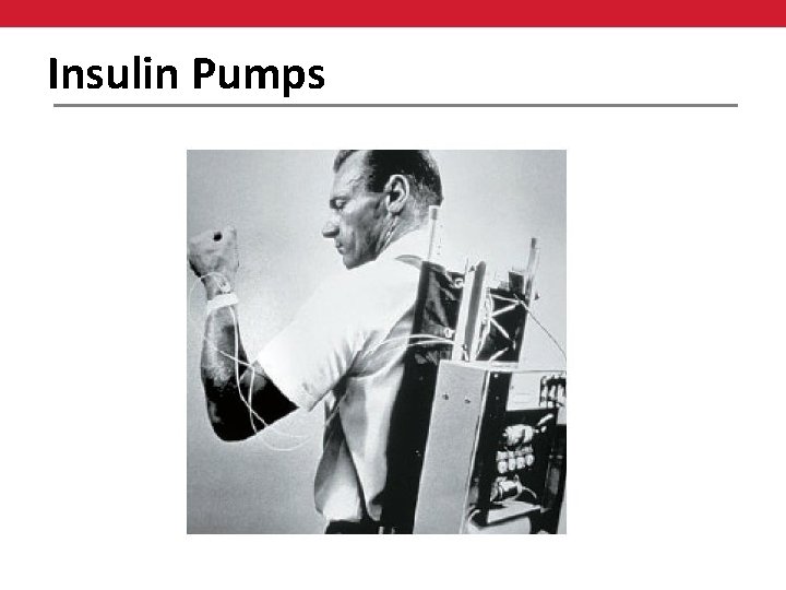 Insulin Pumps 