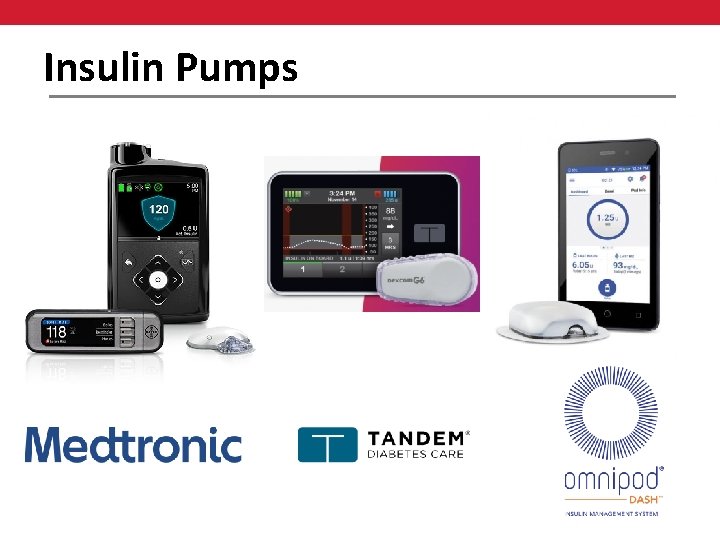 Insulin Pumps 
