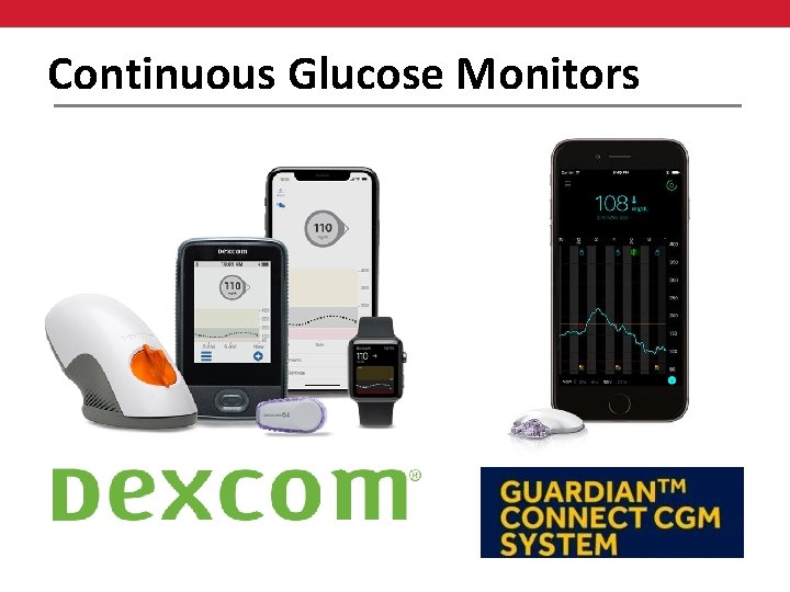 Continuous Glucose Monitors 