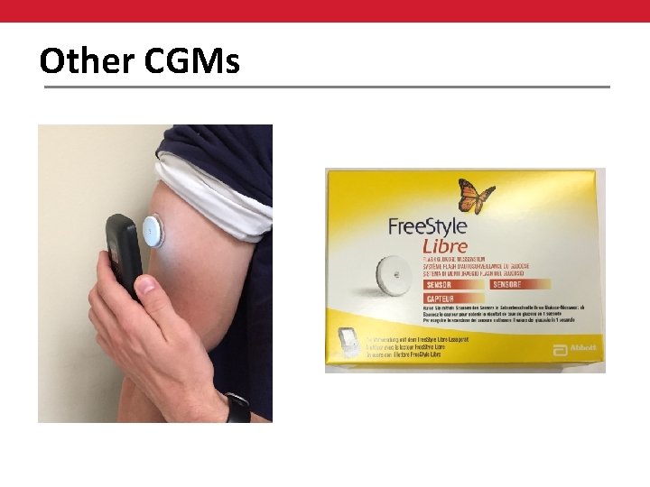 Other CGMs 