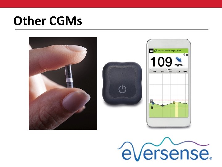 Other CGMs 