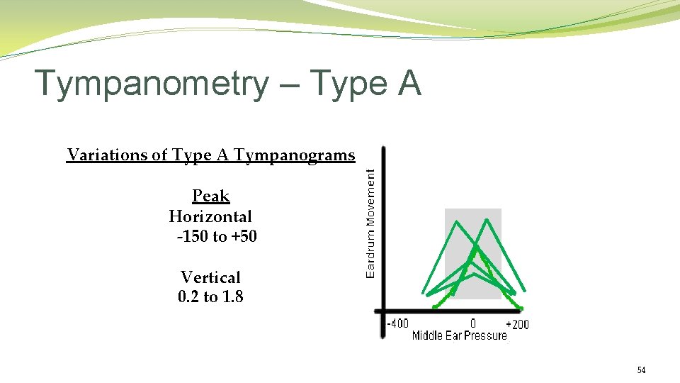Tympanometry – Type A Variations of Type A Tympanograms Peak Horizontal -150 to +50 Tympanometry – Type A Variations of Type A Tympanograms Peak Horizontal -150 to +50