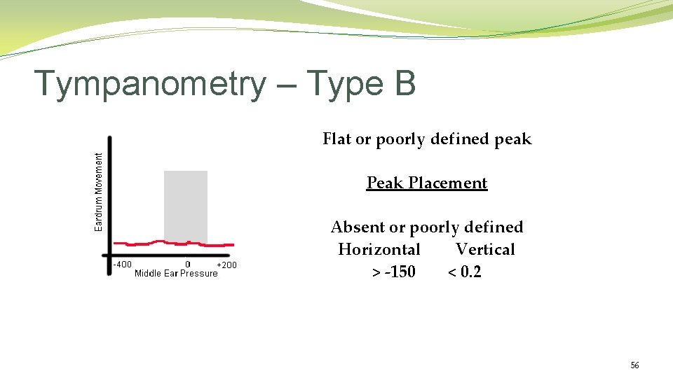 Tympanometry – Type B Flat or poorly defined peak Placement Absent or poorly defined Tympanometry – Type B Flat or poorly defined peak Placement Absent or poorly defined