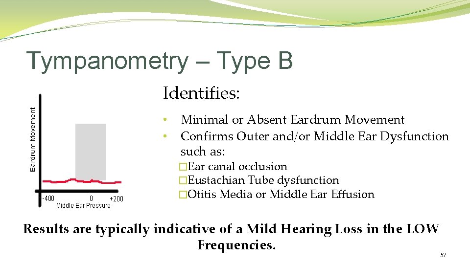 Tympanometry – Type B Identifies: • • Minimal or Absent Eardrum Movement Confirms Outer Tympanometry – Type B Identifies: • • Minimal or Absent Eardrum Movement Confirms Outer