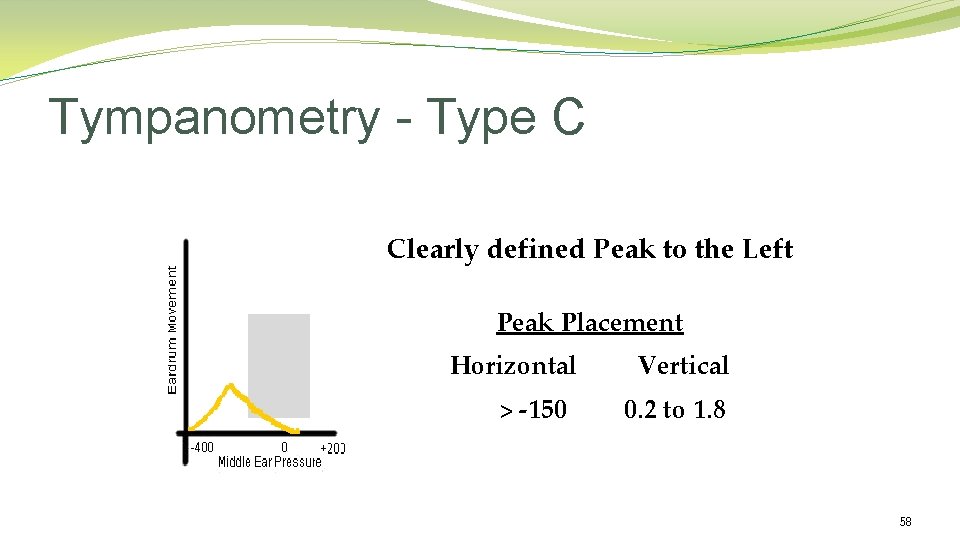 Tympanometry - Type C Clearly defined Peak to the Left Peak Placement Horizontal > Tympanometry - Type C Clearly defined Peak to the Left Peak Placement Horizontal >
