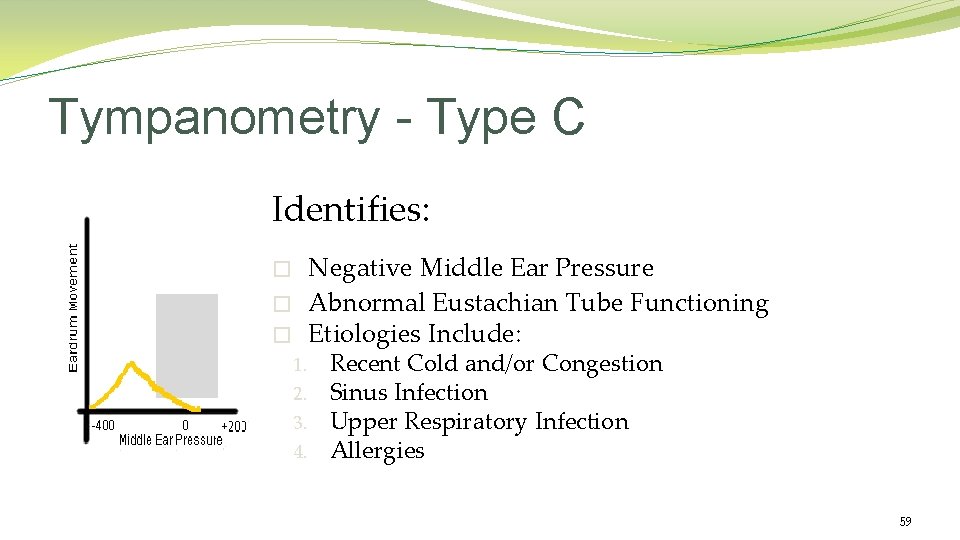 Tympanometry - Type C Identifies: Negative Middle Ear Pressure Abnormal Eustachian Tube Functioning Etiologies Tympanometry - Type C Identifies: Negative Middle Ear Pressure Abnormal Eustachian Tube Functioning Etiologies