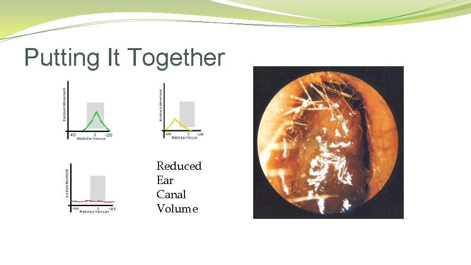 Putting It Together Reduced Ear Canal Volume Putting It Together Reduced Ear Canal Volume