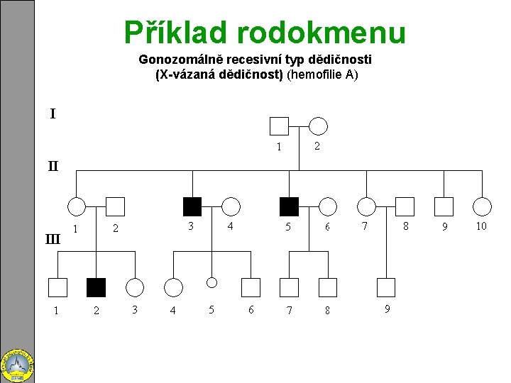 Příklad rodokmenu Gonozomálně recesivní typ dědičnosti (X-vázaná dědičnost) (hemofilie A) 