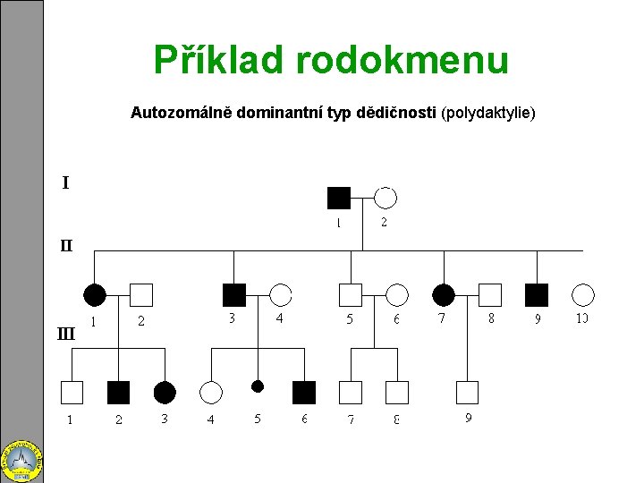 Příklad rodokmenu Autozomálně dominantní typ dědičnosti (polydaktylie) 