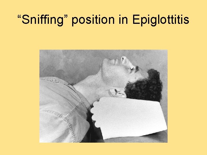 “Sniffing” position in Epiglottitis 