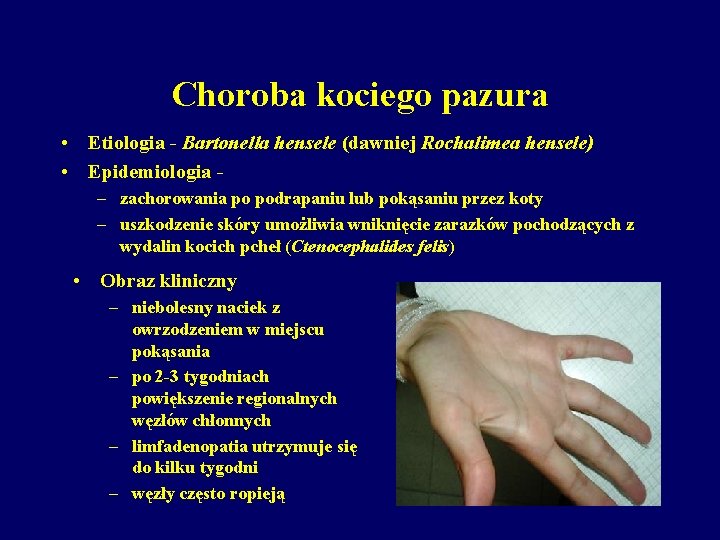 Choroba kociego pazura • Etiologia - Bartonella hensele (dawniej Rochalimea hensele) • Epidemiologia –