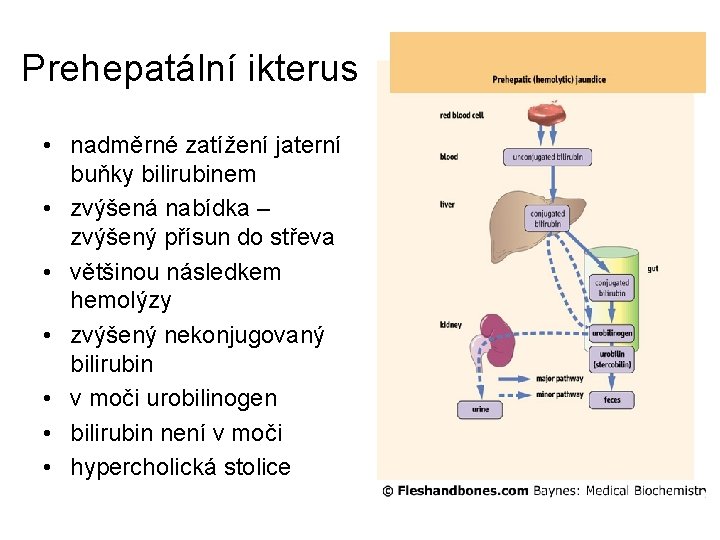 Prehepatální ikterus • nadměrné zatížení jaterní buňky bilirubinem • zvýšená nabídka – zvýšený přísun