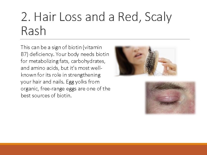 2. Hair Loss and a Red, Scaly Rash This can be a sign of