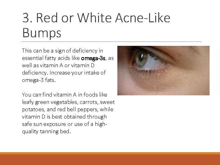 3. Red or White Acne-Like Bumps This can be a sign of deficiency in