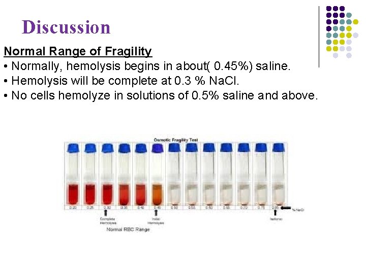 Discussion Normal Range of Fragility. • Normally, hemolysis begins in about( 0. 45%) saline.