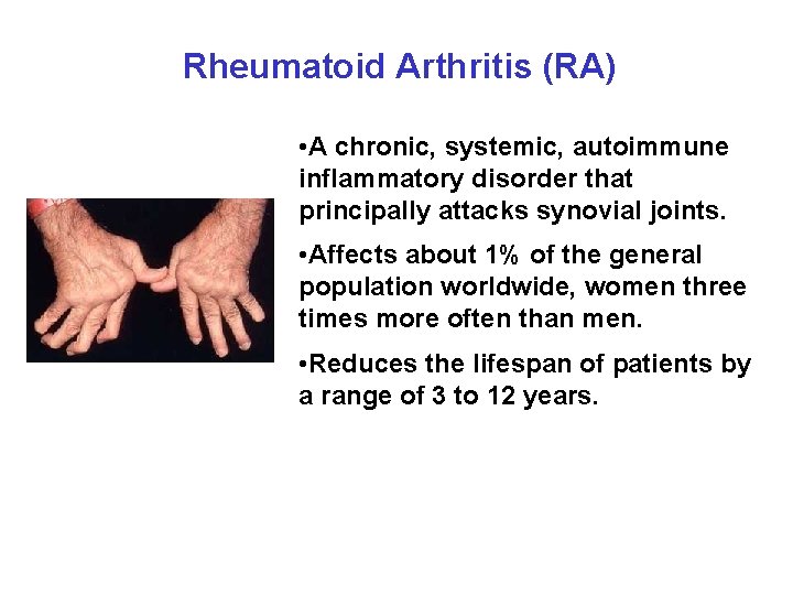 Rheumatoid Arthritis (RA) • A chronic, systemic, autoimmune inflammatory disorder that principally attacks synovial