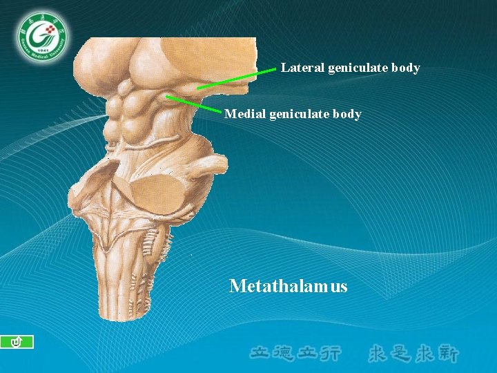Lateral geniculate body Medial geniculate body Metathalamus Lateral geniculate body Medial geniculate body Metathalamus