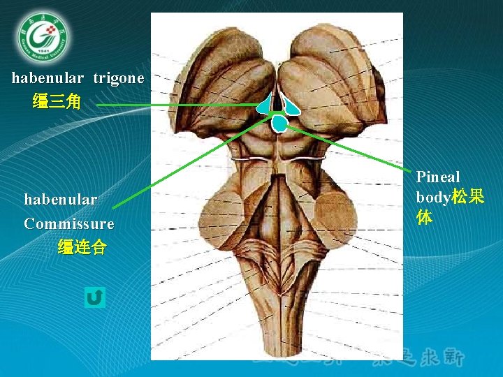 habenular trigone 缰三角 habenular Commissure 缰连合 Pineal body松果 体 