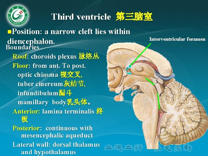 Third ventricle 第三脑室 n. Position: a narrow cleft lies within diencephalon. Boundaries Roof: choroids Third ventricle 第三脑室 n. Position: a narrow cleft lies within diencephalon. Boundaries Roof: choroids