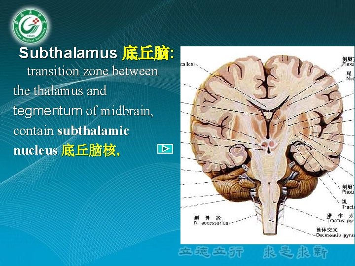 Subthalamus 底丘脑: transition zone between the thalamus and tegmentum of midbrain, contain subthalamic nucleus Subthalamus 底丘脑: transition zone between the thalamus and tegmentum of midbrain, contain subthalamic nucleus