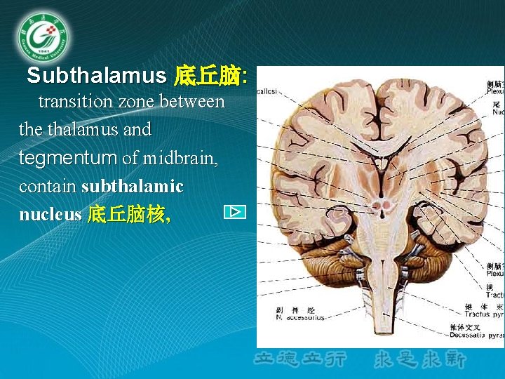 Subthalamus 底丘脑: transition zone between the thalamus and tegmentum of midbrain, contain subthalamic nucleus