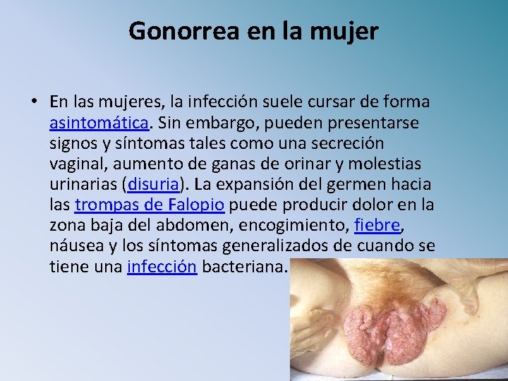 Gonorrea en la mujer • En las mujeres, la infección suele cursar de forma