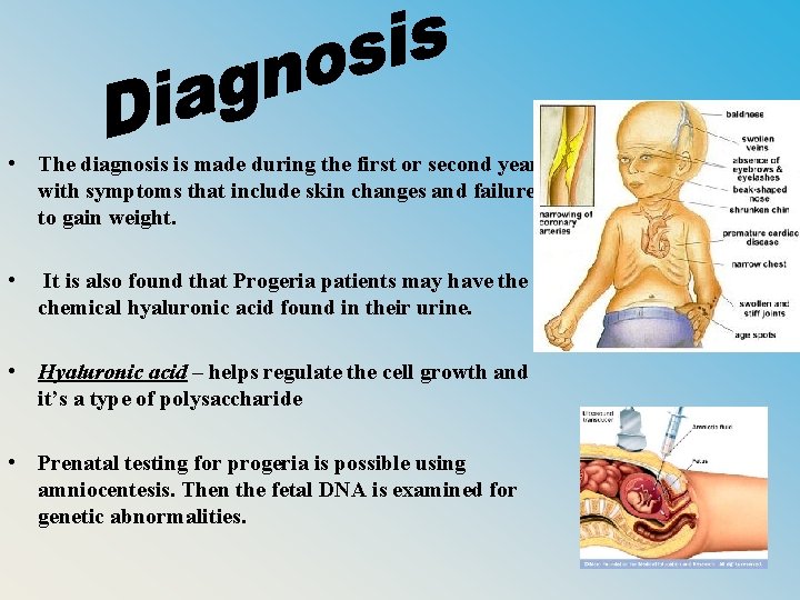  • The diagnosis is made during the first or second year with symptoms