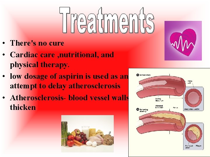  • There's no cure • Cardiac care , nutritional, and physical therapy. •