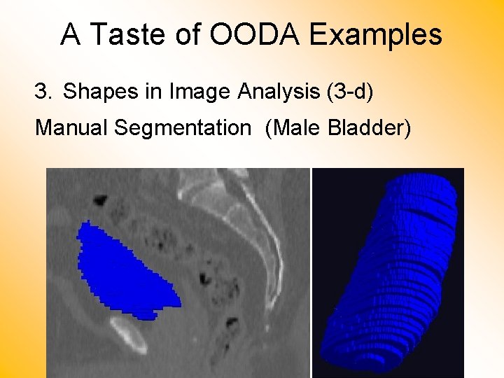 A Taste of OODA Examples 3. Shapes in Image Analysis (3 -d) Manual Segmentation