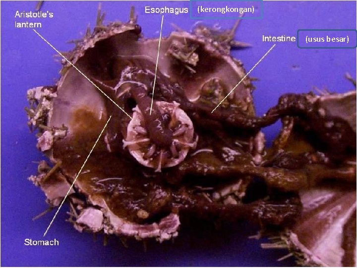 (kerongkongan) (usus besar) 