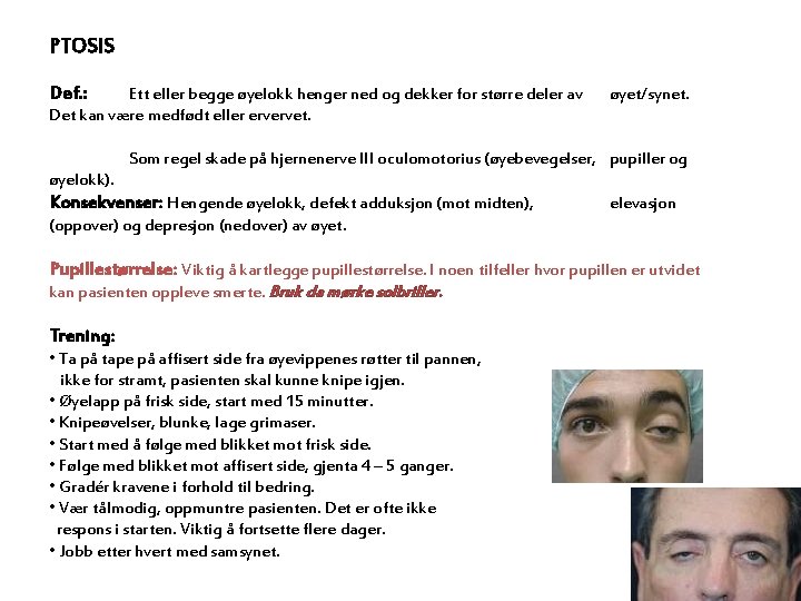 PTOSIS Def. : Ett eller begge øyelokk henger ned og dekker for større deler