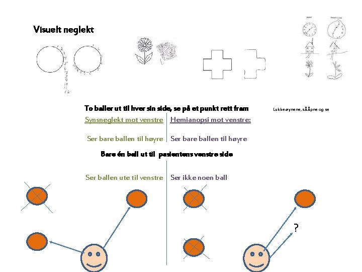 Visuelt neglekt To baller ut til hver sin side, se på et punkt rett