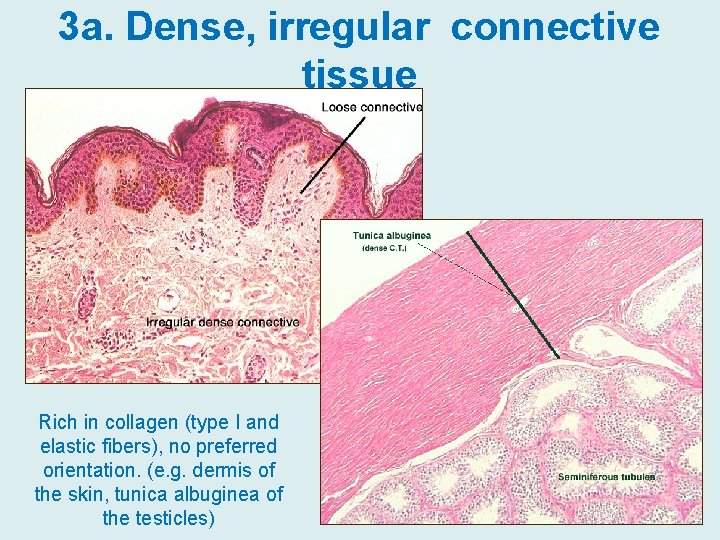 3 a. Dense, irregular connective tissue Rich in collagen (type I and elastic fibers),